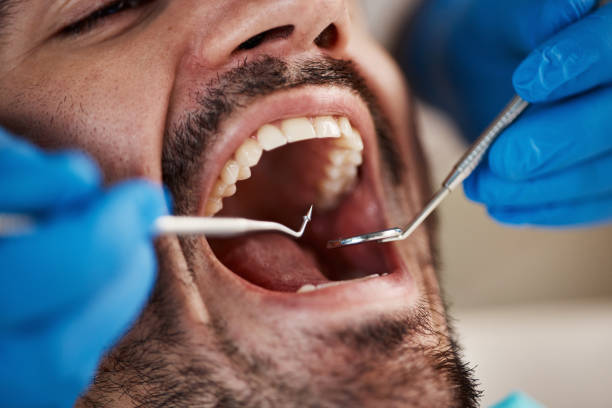 Best Emergency Dental Care for Trauma or Injury in Cedar Rapids, IA